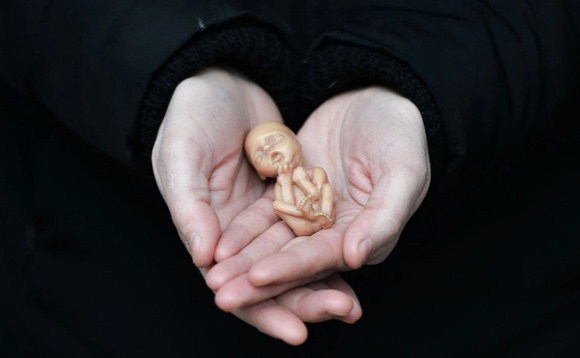 Аборт. Фото: Charles McQuillan / Getty Images